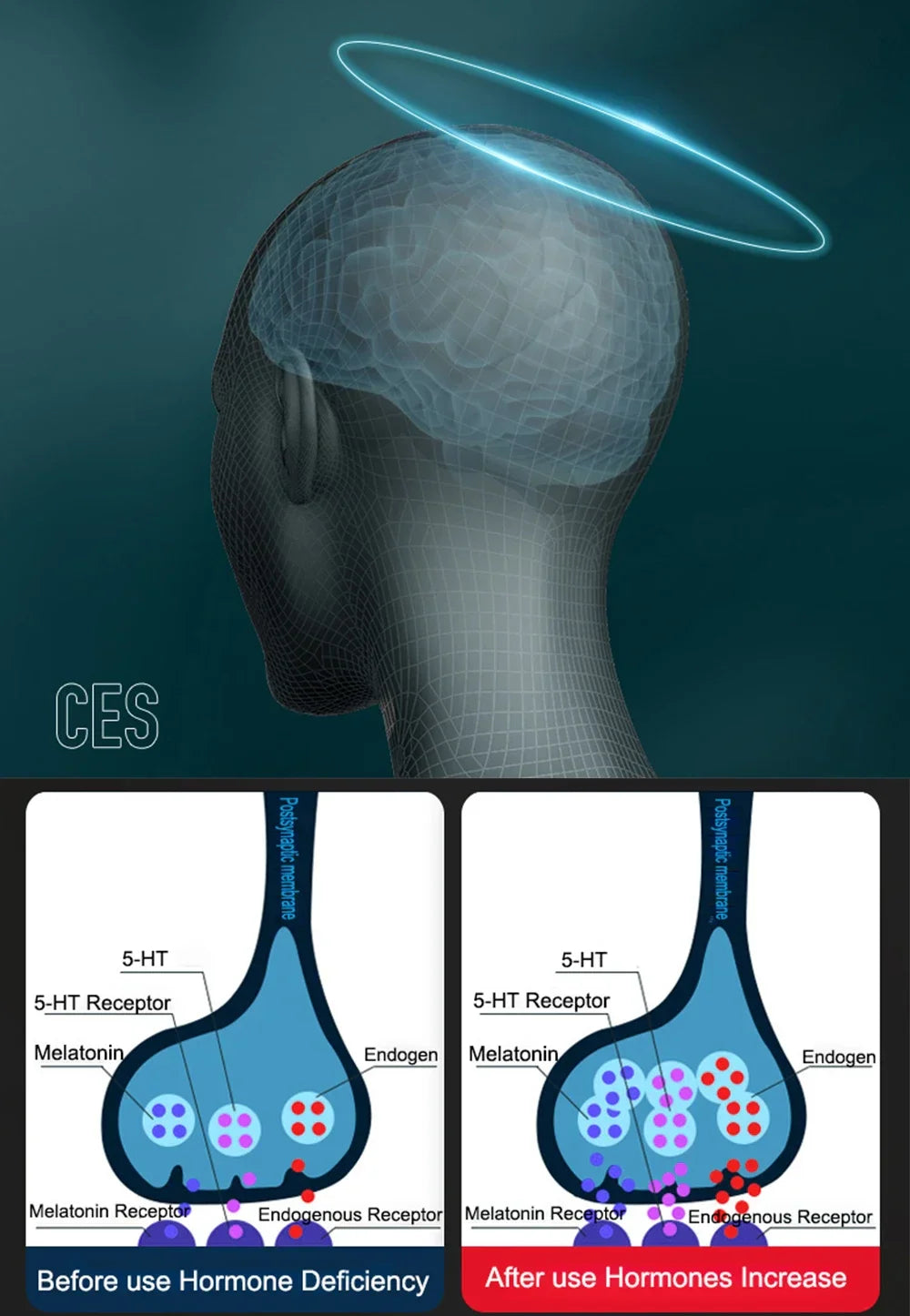 Vagus Nerve Stimulation Ear Clip — Sleep Aid Device for Insomnia, Deep Sleep, Anxiety, and Depression Relief