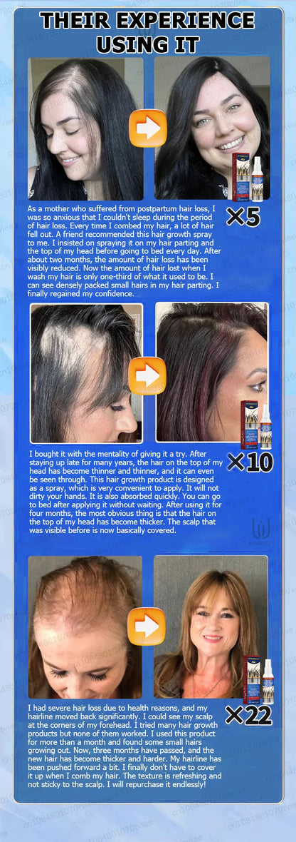 Hair Water Spray – Specially Formulated for Regular Use to Nourish and Revitalize Hair