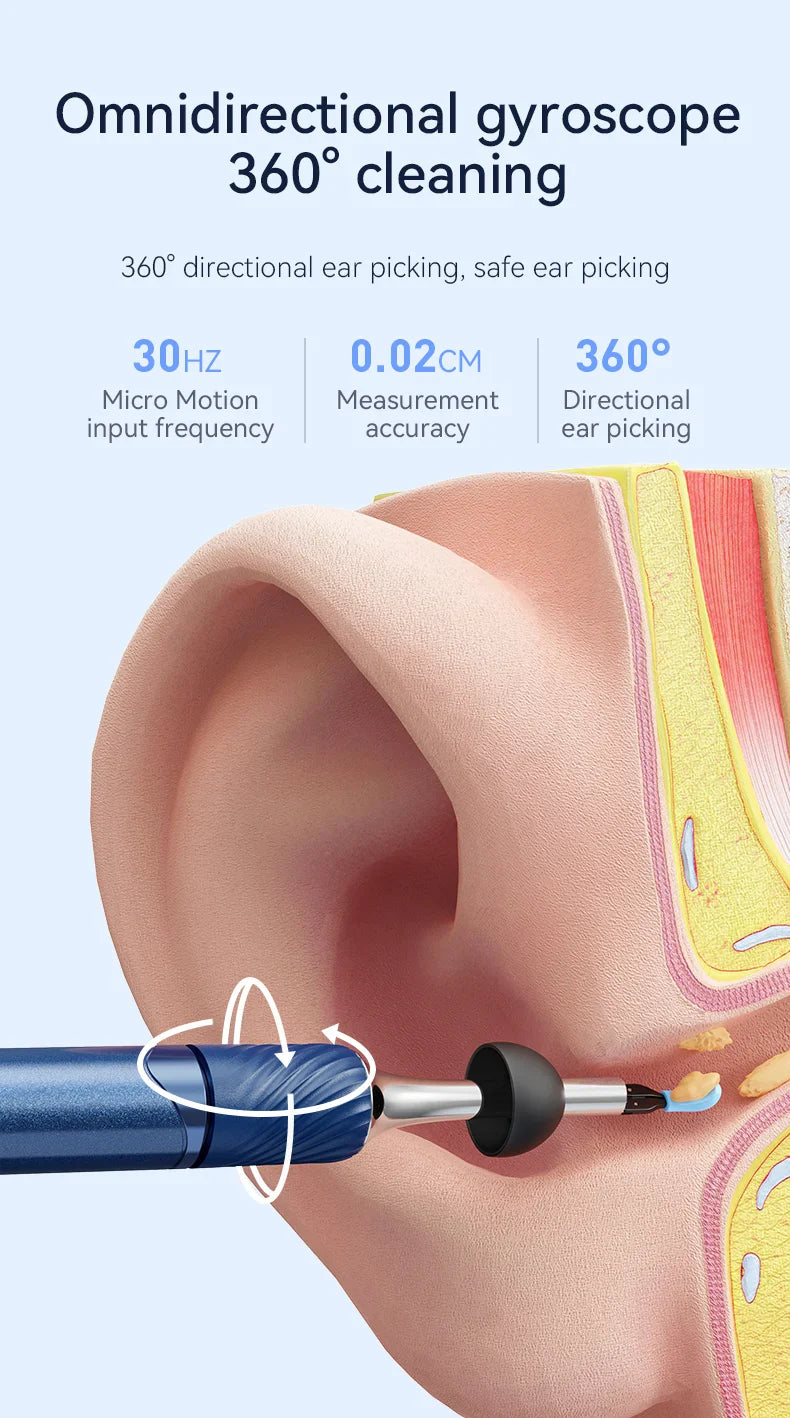 Visual Ear Cleaner with Camera – Ear Wax Removal Tool with 12MP, Ear Pick, Tweezers & 6 Ear Spoons for Ear Care