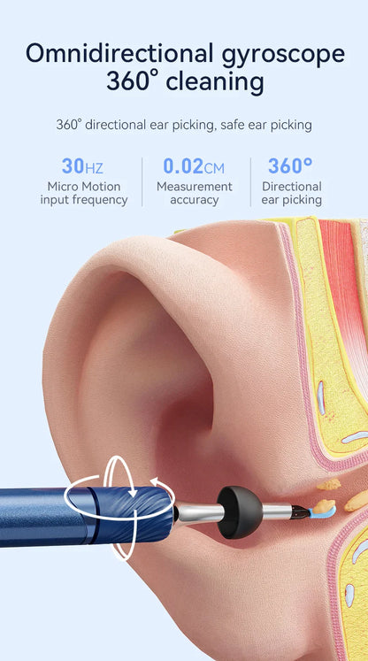 Visual Ear Cleaner with Camera – Ear Wax Removal Tool with 12MP, Ear Pick, Tweezers & 6 Ear Spoons for Ear Care