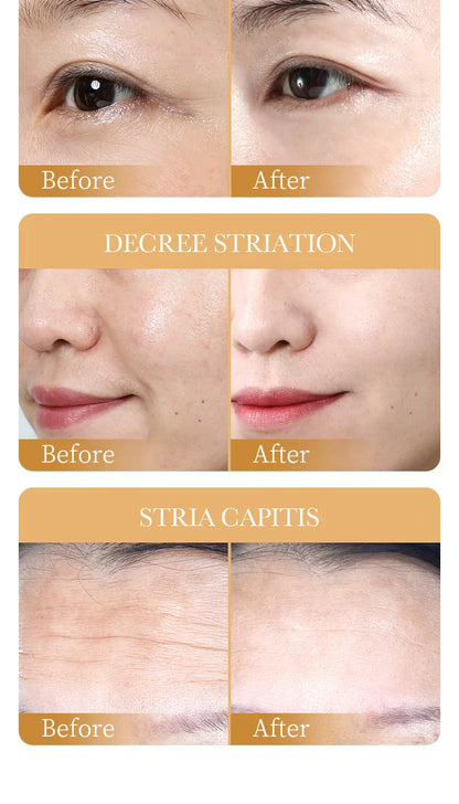 10PCS Collagen Anti-Wrinkle Facial Masks – Korean Skincare for Anti-Aging, Firming, Moisturizing & Brightening