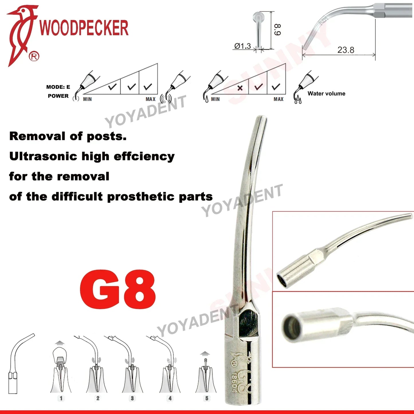 Woodpecker Dental Scaler Tips – Ultrasonic Tooth Cleaning, Endo & Perio Scaling Tips, Fit EMS UDS Scaler Handpiece