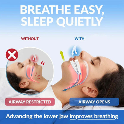 Adjustable Anti-Snoring Mouth Guard – Night Mouthpiece for Bruxism and Sleep Aid Snoring Relief