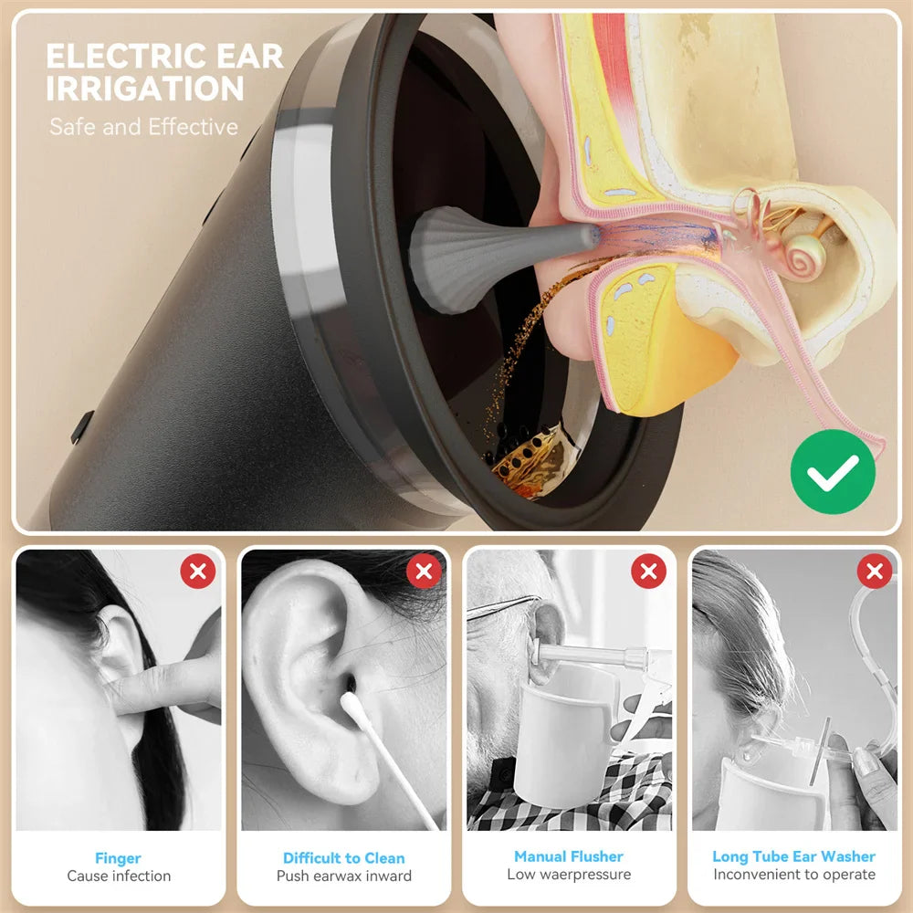 Electric Ear Wax Removal System – Water Powered Ear Cleaner with Irrigation Flusher, 3 Pressure Settings for Safe & Effective Ear Care Tool