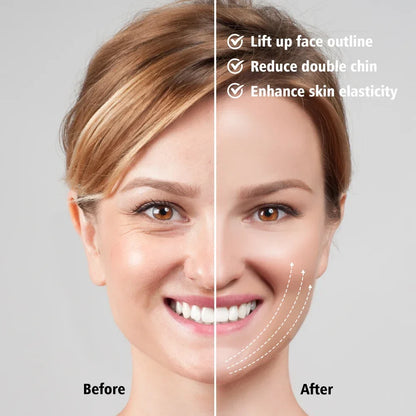 EMS Face Lifting Massager – Anti-Wrinkle, Firming V-Face Lift Microcurrent Device for Double Chin Skin Care