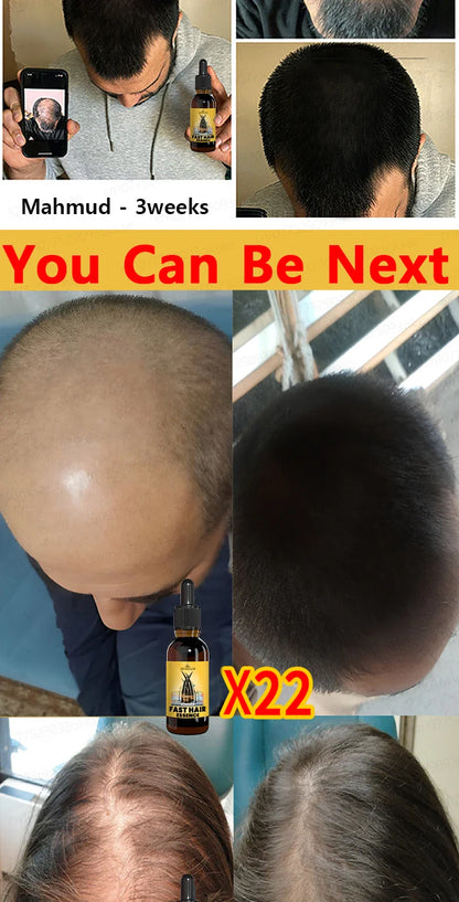 Rapid Hair Growth Serum – Beard, Chest & Body Hair Enhancer for Fuller, Thicker Growth