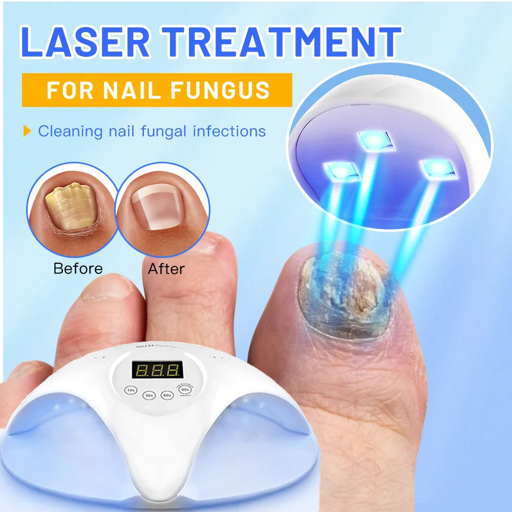 Fungal Nail Laser Device – Fast Toenail & Fingernail Fungus Repair, Onychomycosis Treatment for Hand & Foot Care