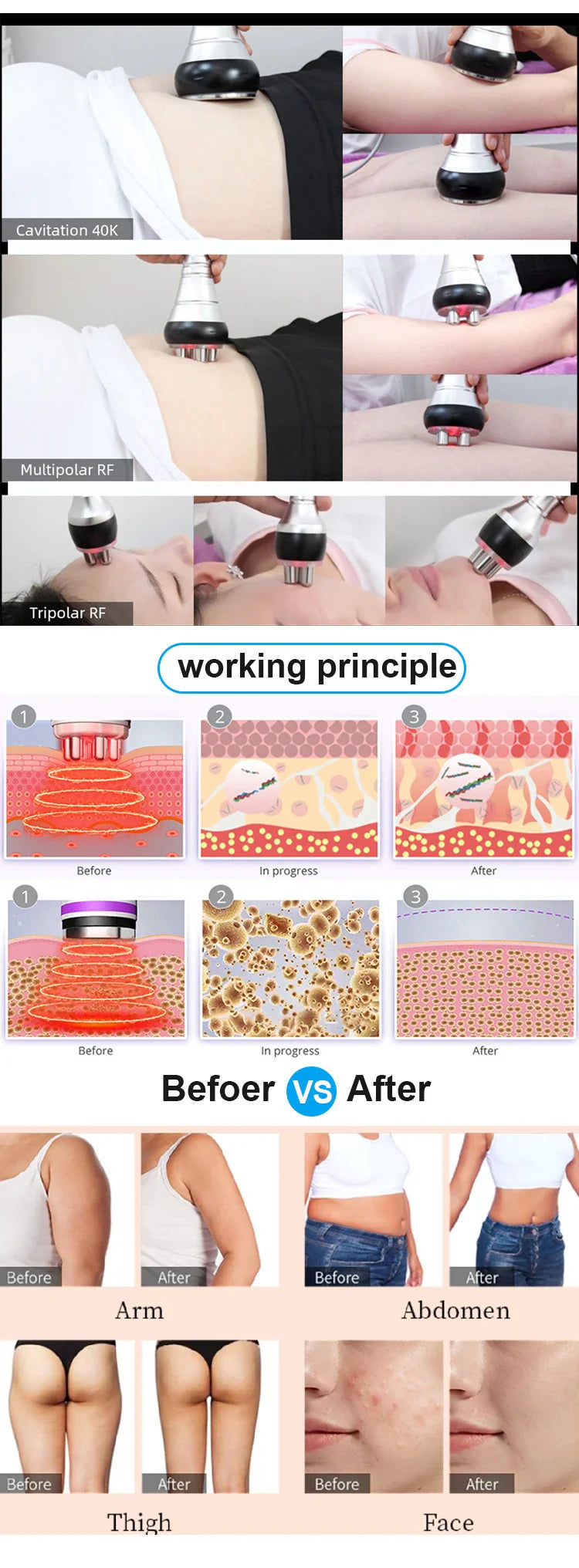 3-in-1 Beauty Body Slimming Massager – Cavitation Machine for Face & Body Tightening, Lifting, and Skincare