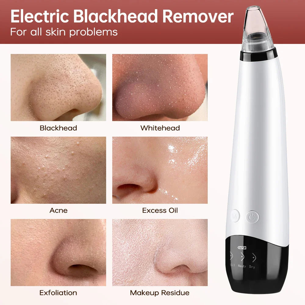 3-Mode Blackhead Remover Vacuum – Facial Pore Cleaner & Dead Skin Removal Beauty Tool