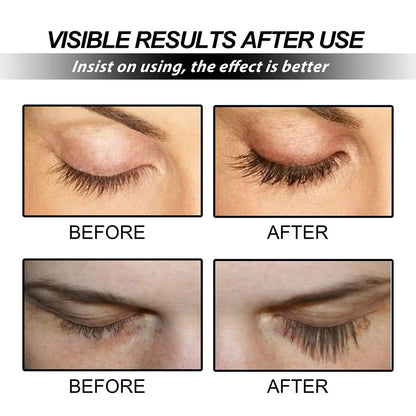 Fast Eyelash Growth Serum – Natural Thick Eyebrow & Eyelash Treatment, Darkening & Traceless Eye Care Lotion