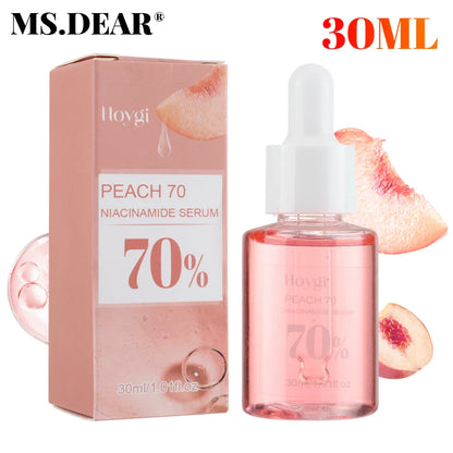 30ml Niacinamide Serum – Dark Spot Corrector, Melanin Removal & Pore-Shrinking Hydrating Skin Care