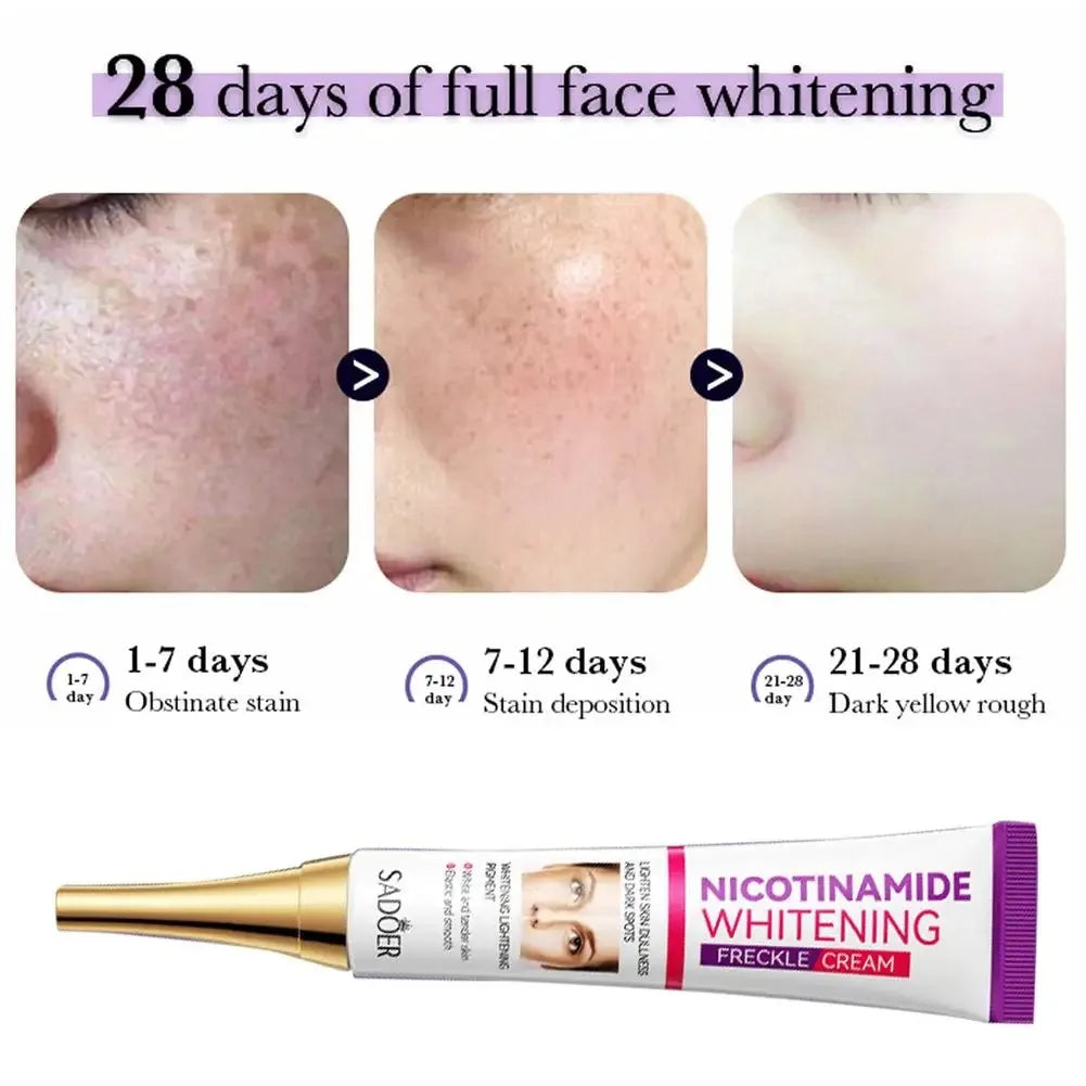 SADOER Nicotinamide Freckle & Dark Spot Cream – Melasma Removal Whitening Face Cream for Brightening & Moisturizing Skin Care