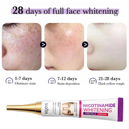 SADOER Nicotinamide Freckle & Dark Spot Cream – Melasma Removal Whitening Face Cream for Brightening & Moisturizing Skin Care