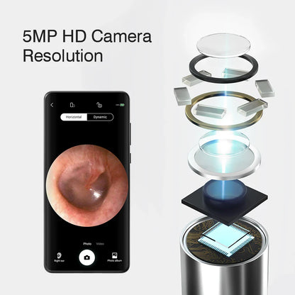 Wireless Visual Ear Endoscope Camera – 5MP Ear Cleaning Tools with Safe Silicone Earpick, Luminous Otoscope & Ear Wax Remover