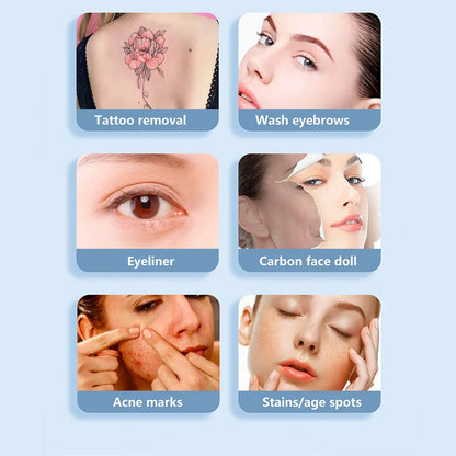 Q-Switch ND YAG Laser Machine – Tattoo & Eyebrow Removal, Mole & Freckle Whitening (532nm 755nm 1064nm)