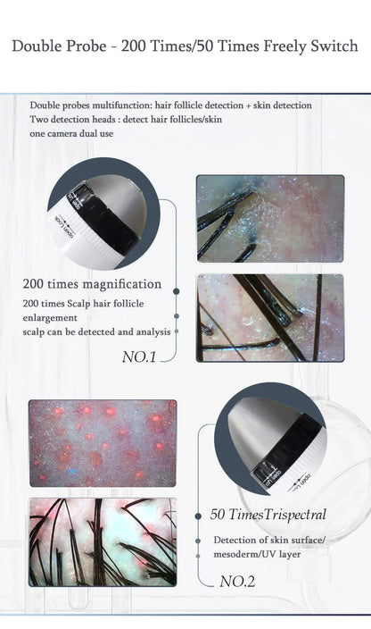WiFi HD 5G Scalp, Skin & Hair Follicle Detector – 50X/200X Rechargeable UV Skin Analyzer Magnifier