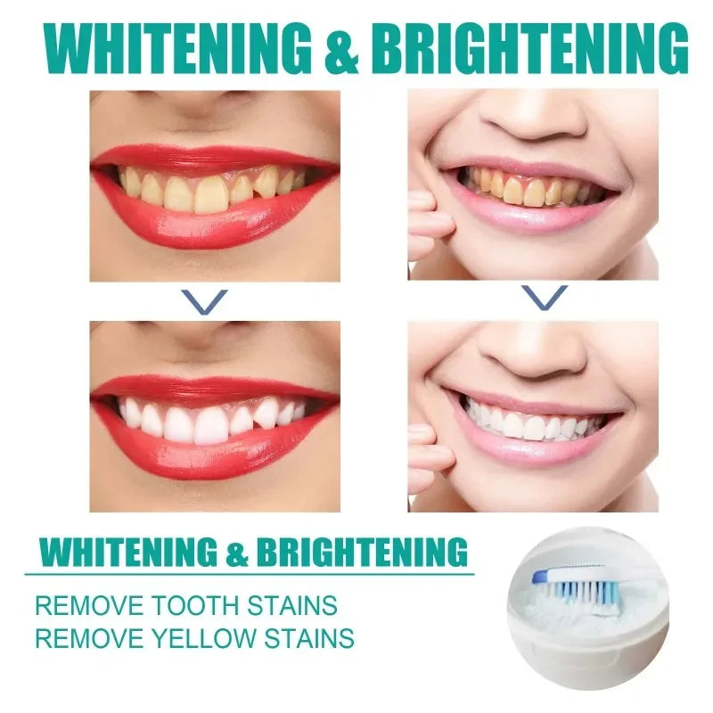 5 Day Teeth Whitening Powder – Removes Plaque & Stains, Deep Cleaning, Fresh Breath & Oral Hygiene Care