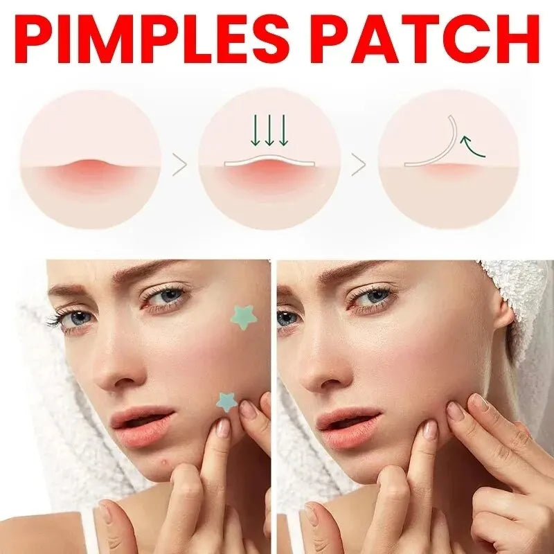 Acne Repair Patch - Facial Skin Care for Blemish & Pimple Marks, Acne Treatment & Pimple Repair Cover