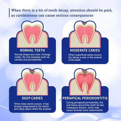 Anti-Decay Toothpaste – Deep Cleaning, Plaque Removal & Toothache Relief, Protects Teeth & Repairs Periodontitis