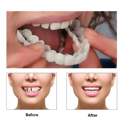 Silicone Denture Set – Temporary Orthodontic Teeth, Fake Teeth for Oral Hygiene, Whitening, and Dental Braces Simulation