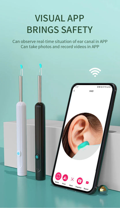 Smart Visual Ear Cleaner 1296P with Camera – USB-C Rechargeable Ear Wax Removal Tool, WiFi, 6 LED Lights