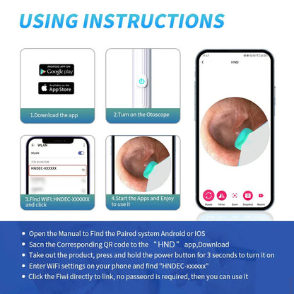 Smart Visual Ear Cleaner 1296P with Camera – USB-C Rechargeable Ear Wax Removal Tool, WiFi, 6 LED Lights