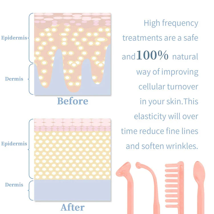 4 in 1 Electrode Glass Tube Machine - High Frequency Skin Spot Acne Wand for Facial Spa & Skin Care Electrotherapy