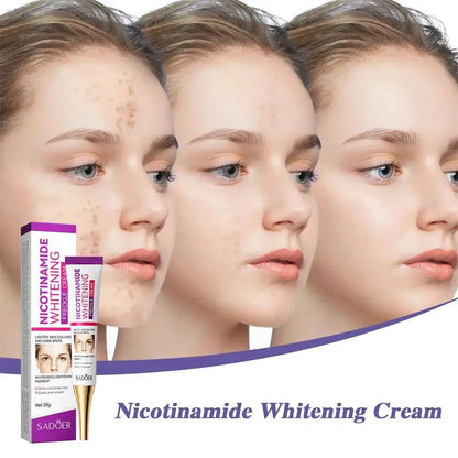 SADOER Nicotinamide Freckle & Dark Spot Cream – Melasma Removal Whitening Face Cream for Brightening & Moisturizing Skin Care