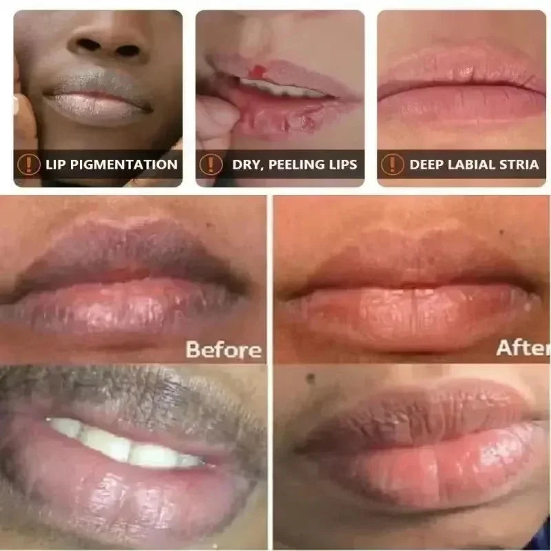 Dark Lip Repair Balm – Moisturizing Exfoliating Lip Treatment for Dry Lips, Fine Lines & Natural Pink Glow