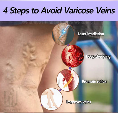 Varicose Vein & Spider Leg Pain Relief Treatment — Painless Care for Vasculitis & Phlebitis
