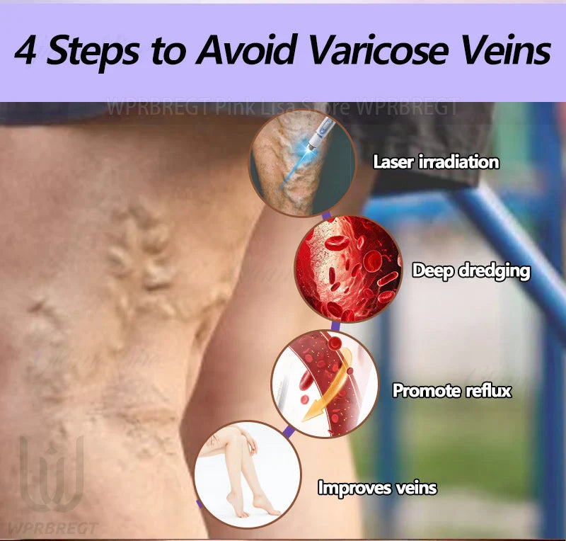 2nd Gen Varicose Vein Laser Therapy Device – Relieves Spider Leg Pain, Treats Vasculitis & Phlebitis