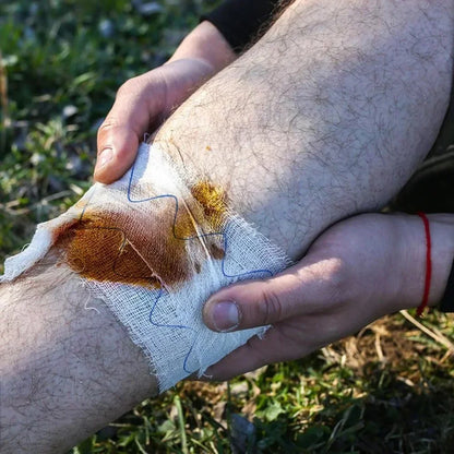 Tactical Kaolin Hemostatic Gauze – Emergency First Aid Bandage for Bleeding & Trauma Wound Dressing