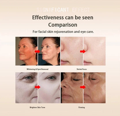 Electroporation Skin Rejuvenation Machine – Facial Whitening, Lifting & Anti-Aging Beauty Care Tool for Cell Activation