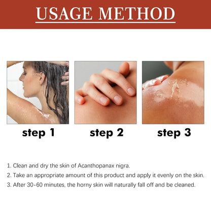 EELHOE Peeling Oil for Dark Skin — 110ml Exfoliator to Remove Dead Skin & Brighten Arms, Elbows, Knees, Legs