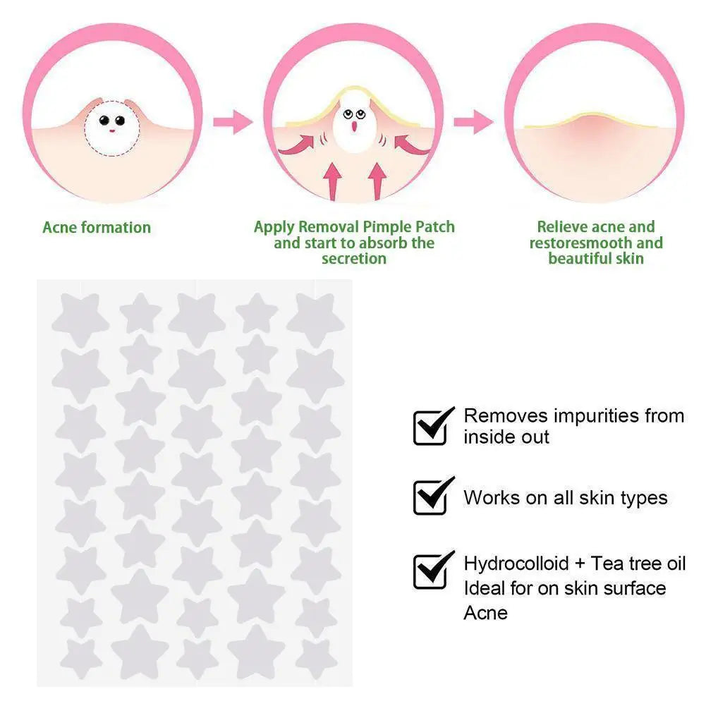 Colorful Star-Shaped PE Pimple Patches – Invisible Acne Spot Stickers for Skin Care and Makeup Concealer