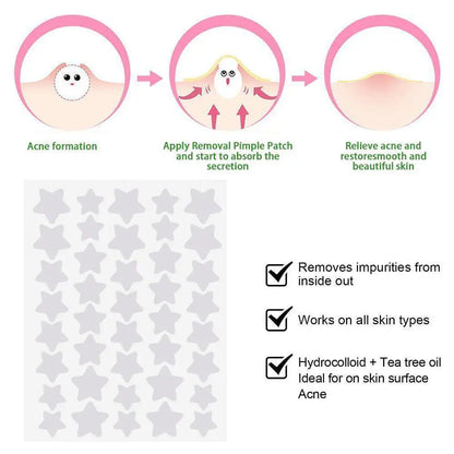 Colorful Star-Shaped PE Pimple Patches – Invisible Acne Spot Stickers for Skin Care and Makeup Concealer