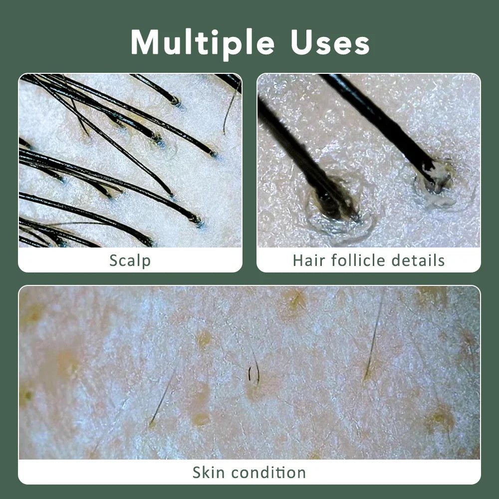 Multifunctional HD Scalp & Skin Analyzer — Hair Follicle Detector with Magnifier for Phone & Tablet