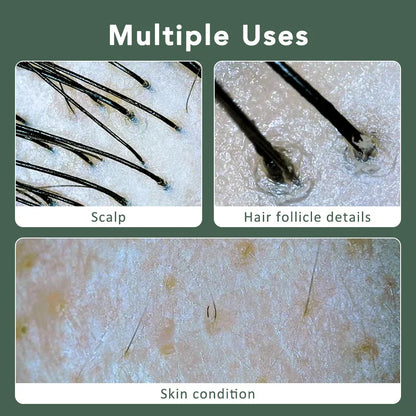 Multifunctional HD Scalp & Skin Analyzer — Hair Follicle Detector with Magnifier for Phone & Tablet