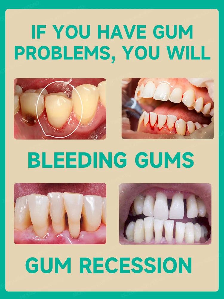 Effective Gum Repair – Relieve Toothache, Strengthen Teeth & Gum Health