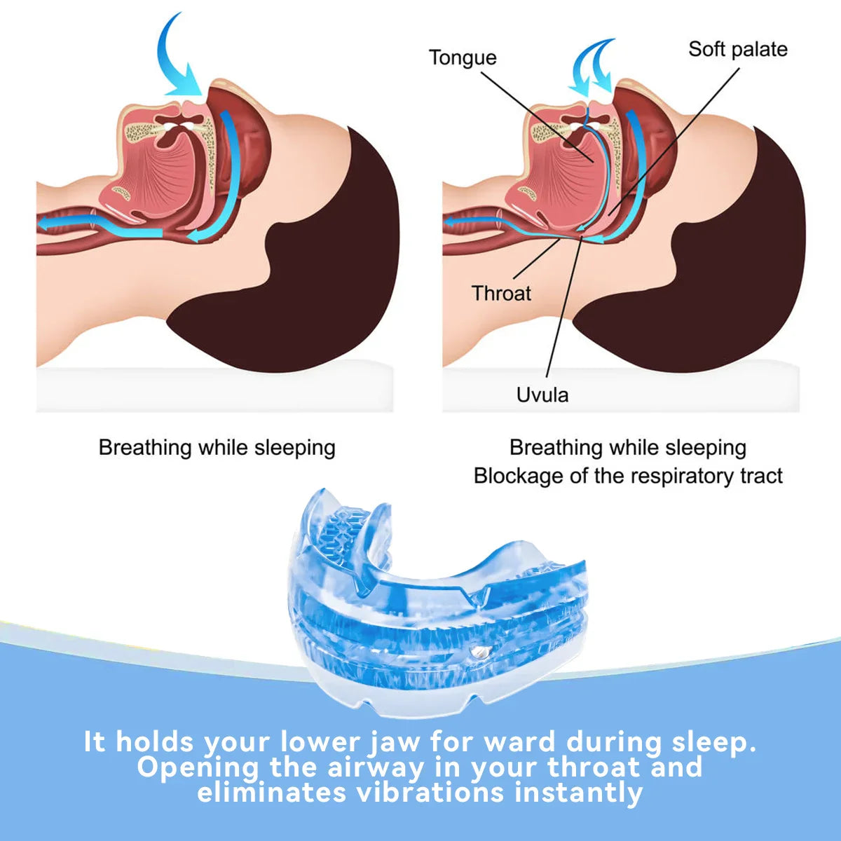 Anti-Snore Mouth Guard for Bruxism – Stop Snoring & Sleep Apnea Aid, Teeth Protection Night Mouthpiece
