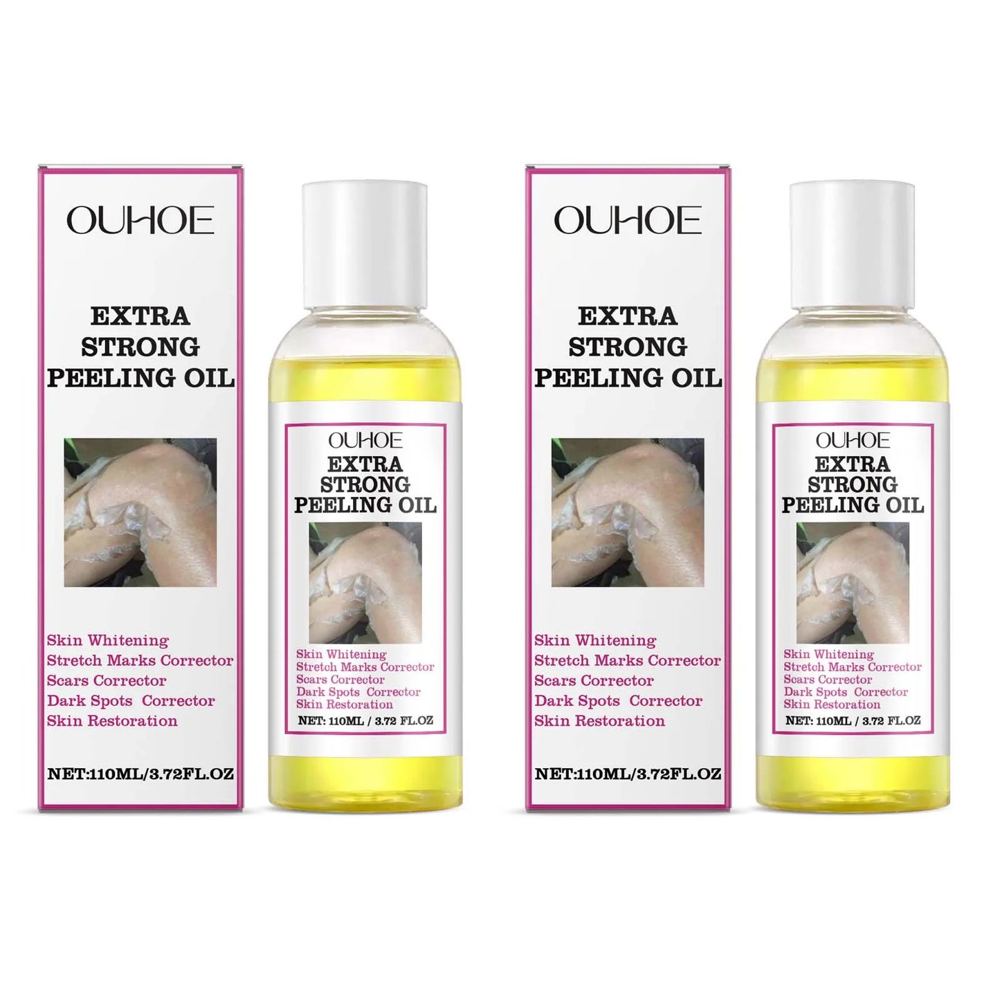 30/110ml Super Strength Body Peeling Oil — Brightening, Moisturizing & Exfoliating Skin Care Oil
