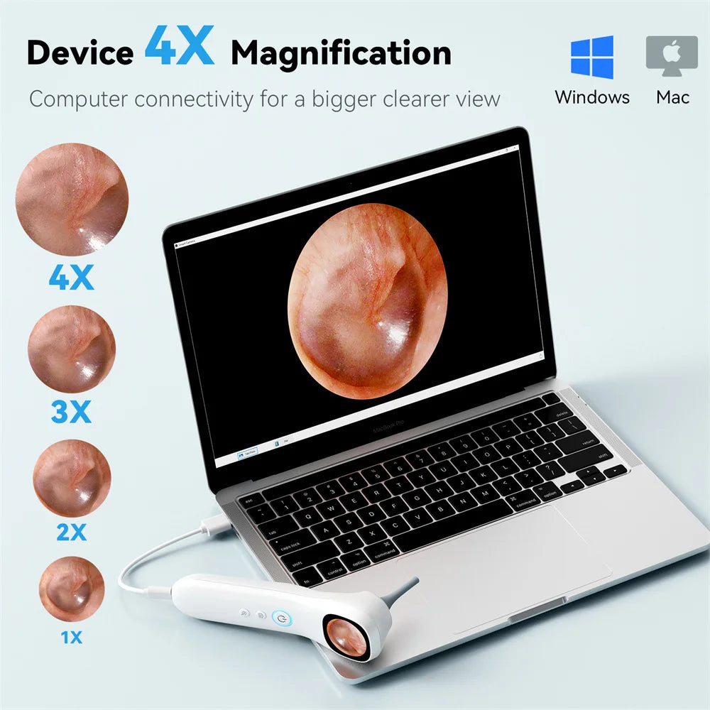5-in-1 Smart Ear Camera with Screen – 1080P HD Earwax Removal Kit with Ear Picks, 6 Tips & 12 Extra Inspection Heads