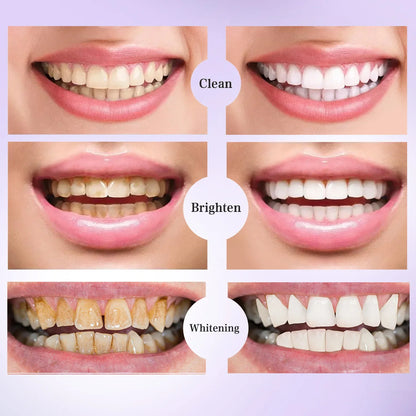 5D Whitening Teeth Stickers – 7/14 Pairs Gel Strips for Stain Removal, Dental Bleaching & Oral Hygiene Care