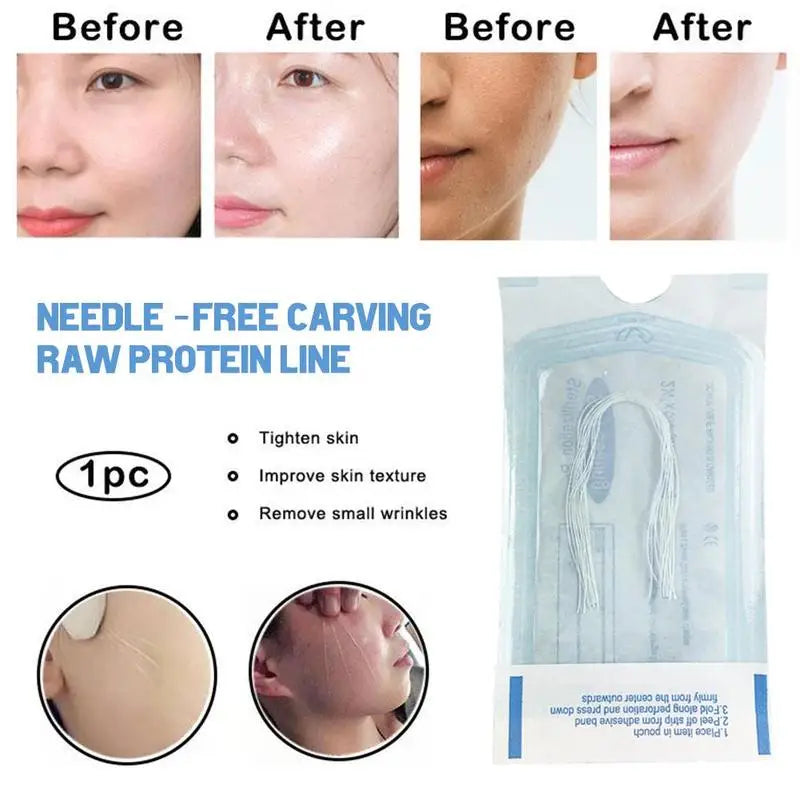60/120PCS Gold Protein Collagen Threads – Absorbable No-Needle Anti-Wrinkle Face Filler for Lifting, Firming & Anti-Aging Skincare