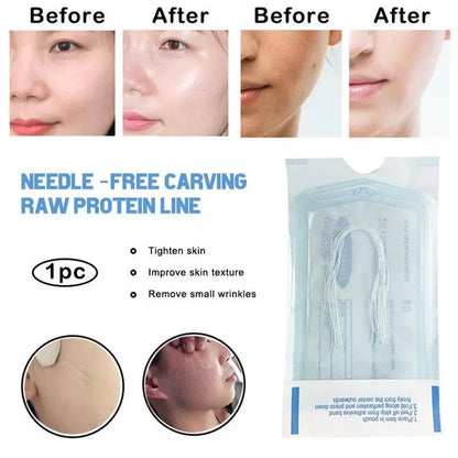 60/120PCS Gold Protein Collagen Threads – Absorbable No-Needle Anti-Wrinkle Face Filler for Lifting, Firming & Anti-Aging Skincare