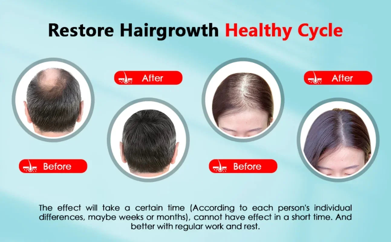 Rechargeable Hair Growth Cap – 2000mAh LED Device for Anti-Hair Loss, Stress & Anxiety Relief, Migraine Reduction, Scalp Massager