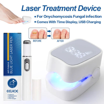 Nail Fungus Treatment Tools – Effective Anti-Fungal Equipment for Toenail & Nail Infection Removal