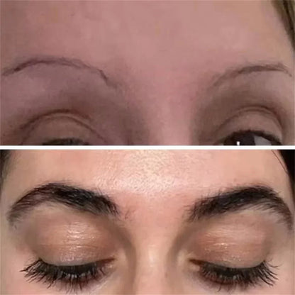 Eyebrow & Eyelash Growth Serum – Fast-Growing, Hair Loss Prevention Treatment for Fuller, Thicker Lashes and Brows