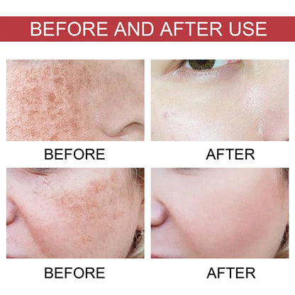 Niacinamide Serum – Dark Spot Correcting, Moisturizing & Brightening, Fades Fine Lines, Deep Cleansing Korean Skincare