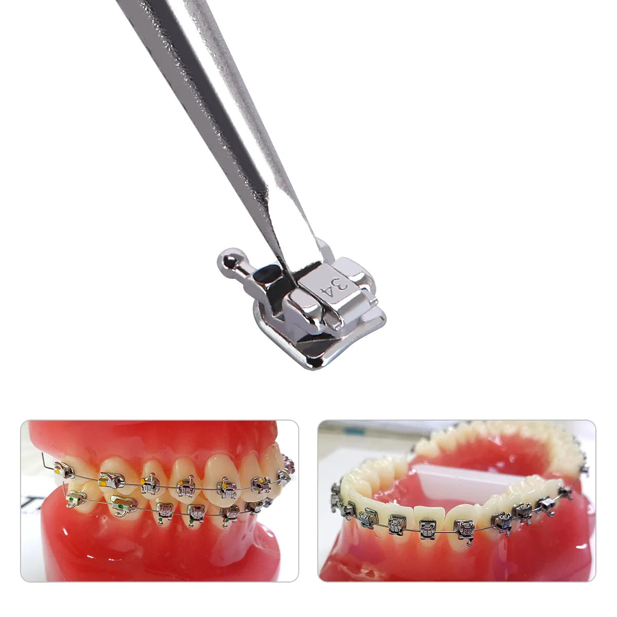 AZDENT 5 Boxes Dental Brackets – Passive Self-Ligating Orthodontic Braces with MIM Monoblock & Buccal Tubes, MBT/Roth 0.022, 345 Hooks